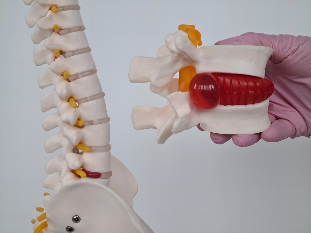 Surgeon for lumbar artificial disc replacement in Pleasanton